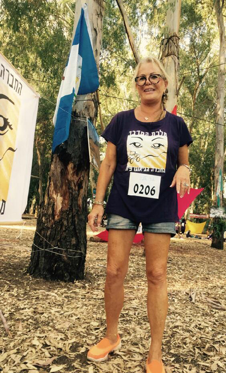 אחרי ניתוח צווארי - דר דוידוביץ